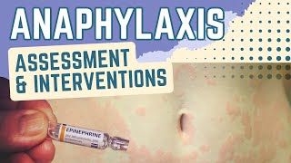 Anaphylaxis- Assessment and Interventions- Nursing