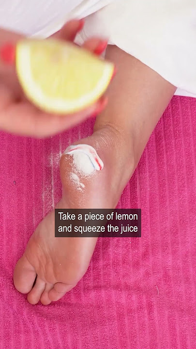 Dry skin on feet disappeared