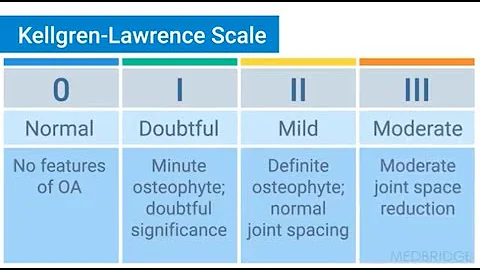 Diagnostic Factors for Knee Osteoarthritis - Eric Robertson | MedBridge