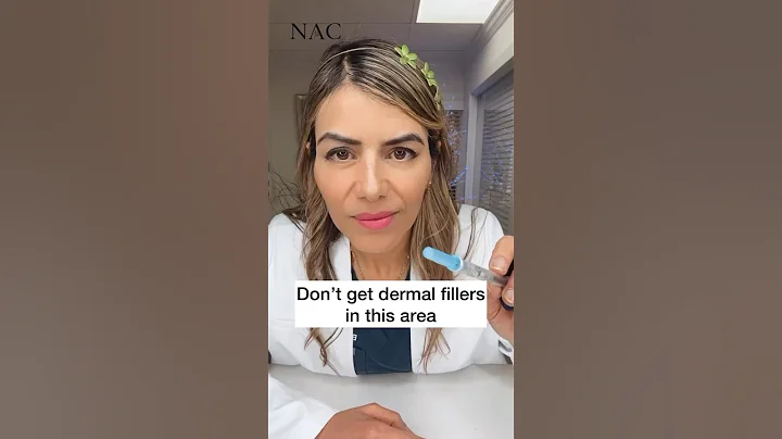 Don't get Dermal Fillers in this area #fillers #fillersinjection #antiaging