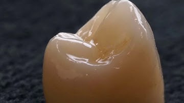 38Smiles Dental Lab and IPS e.max ZirCAD Prime