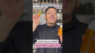 تخلص من حب شباب وتصفية الوجه بالزعفران الحر ?