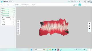 Smile 2 Intraoral Scanner   Finish Scanning