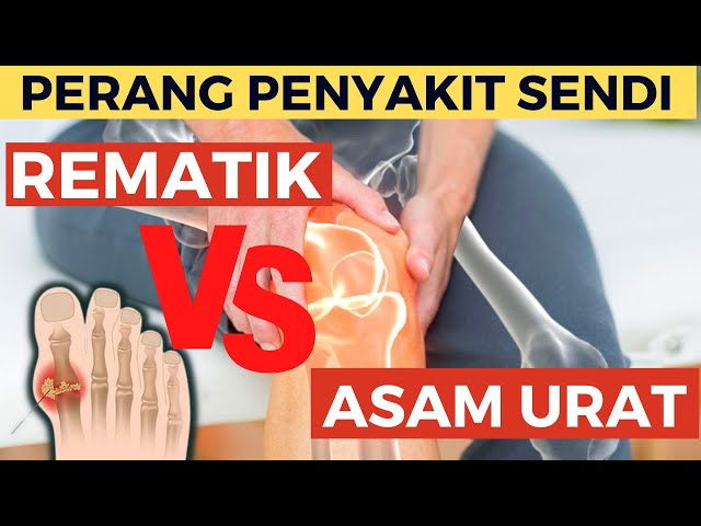 Wajib tau! PERBEDAAN PENYAKIT REMATIK DAN ASAM URAT class=