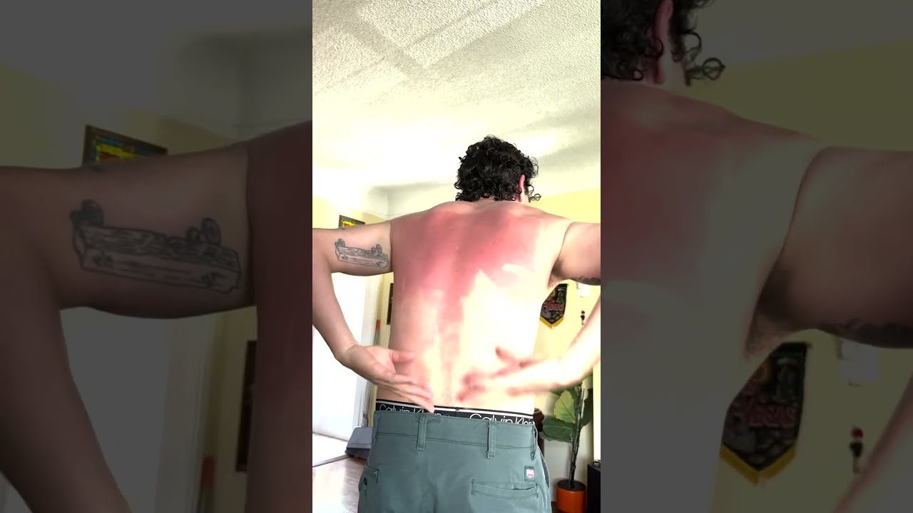 He Tried To Apply Sunscreen Alone Here S The Result