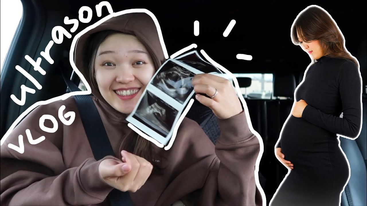 ultrasonda saçlarını gördük😂🤰🏻