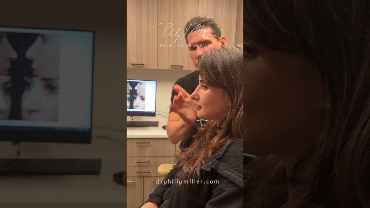 Amazing 7 days pot op revision rhinoplasty!