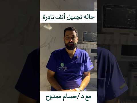حالة نجاح جديدة بعد تجميل الانف الوظيفى مع استشارى تجميل الانف دحسام ممدوح 00201008501413