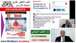 Multiple Myeloma   #cme #internal_medicine #medical #medicalstudent  #usmle #محاضرات_باطنة screenshot 1