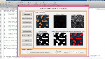 Bacteria Detection MATLAB source code