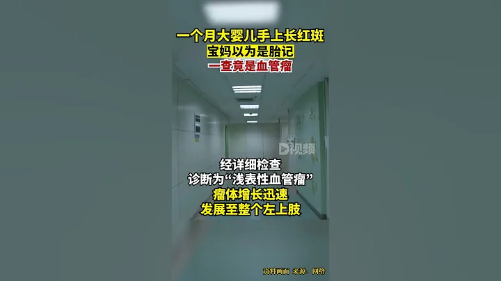 嬰兒手上長胎記一查竟是血管瘤使用外用藥一個月後，該嬰兒大部分皮疹消退。 - 天天要聞