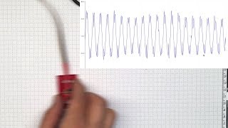 Acceleration Traces