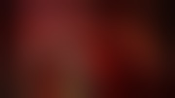 Uniportal VATS double anatomic ipsilateral segmentectomy S3 and S9-10