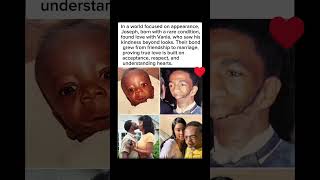 ❤️ A Love That Saw Beyond Appearances #history #viral #story #inspiration #youtubeshorts #humanity