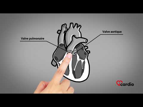 Vidéo: Comment fonctionnent les cœurs multiples ?