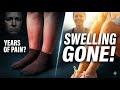 Swollen Legs &amp; Feet for Years? This Simple Habit Changed Everything