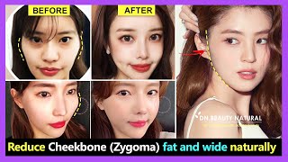 How to reduce Cheekbone fat and wide, Zygomatic bone reduction without surgery | Exercise & Massage