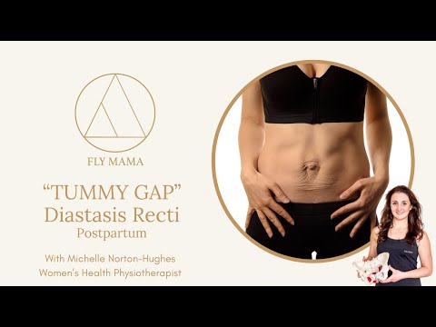 What is a Diastasis Recti / "Tummy Gap" and how can I assess it myself? - video from FLY Mama