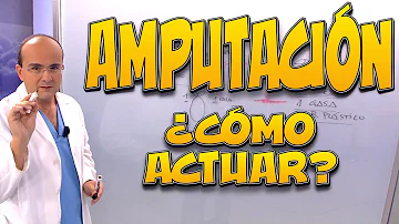 ¿Puede volver a crecer una mano amputada?