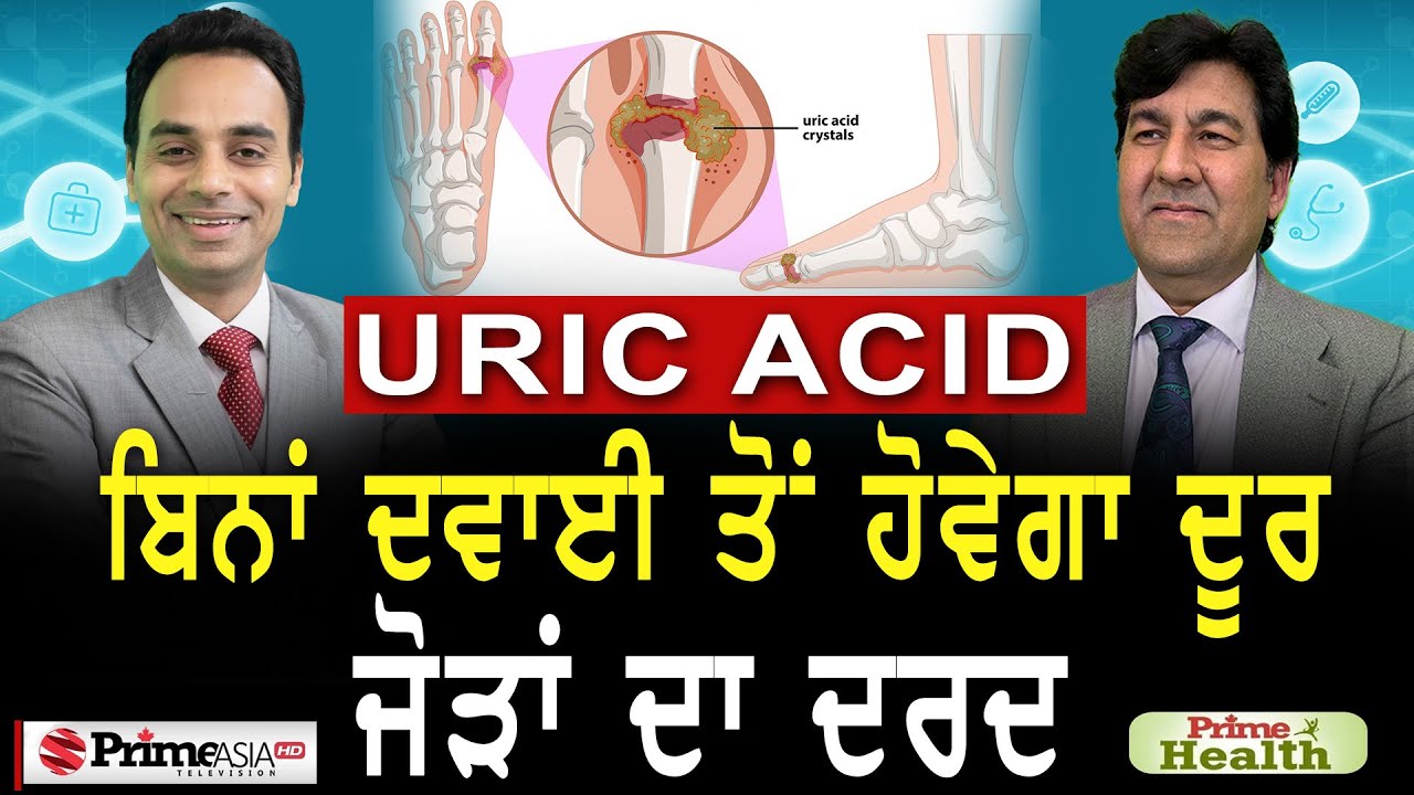 Prime Health (90) Uric acid || ਬਿਨਾਂ ਦਵਾਈ ਤੋਂ ਹੋਵੇਗਾ ਦੂਰ ਜੋੜਾਂ ਦਾ ਦਰਦ