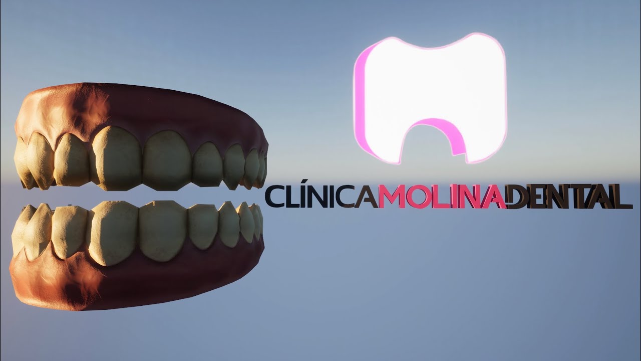 Spot Clínica Molina Dental YouTube