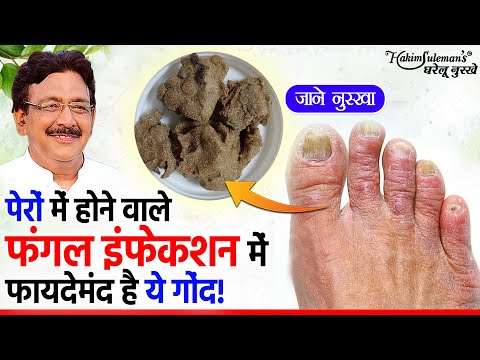 वीडियो: क्या कोविड पैर की उंगलियों में खुजली है?