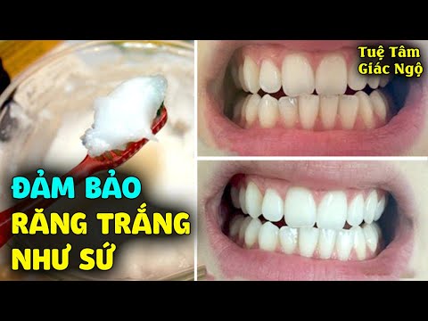 cách chăm sóc răng trắng sáng tại Kemtrinam.vn