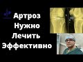 АРТРОЗ КОЛЕННОГО СУСТАВА 3 СТЕПЕНИ | Лечение | Доктор Юршин