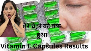 Vitamin E Capsules For Skin  - Results ????
