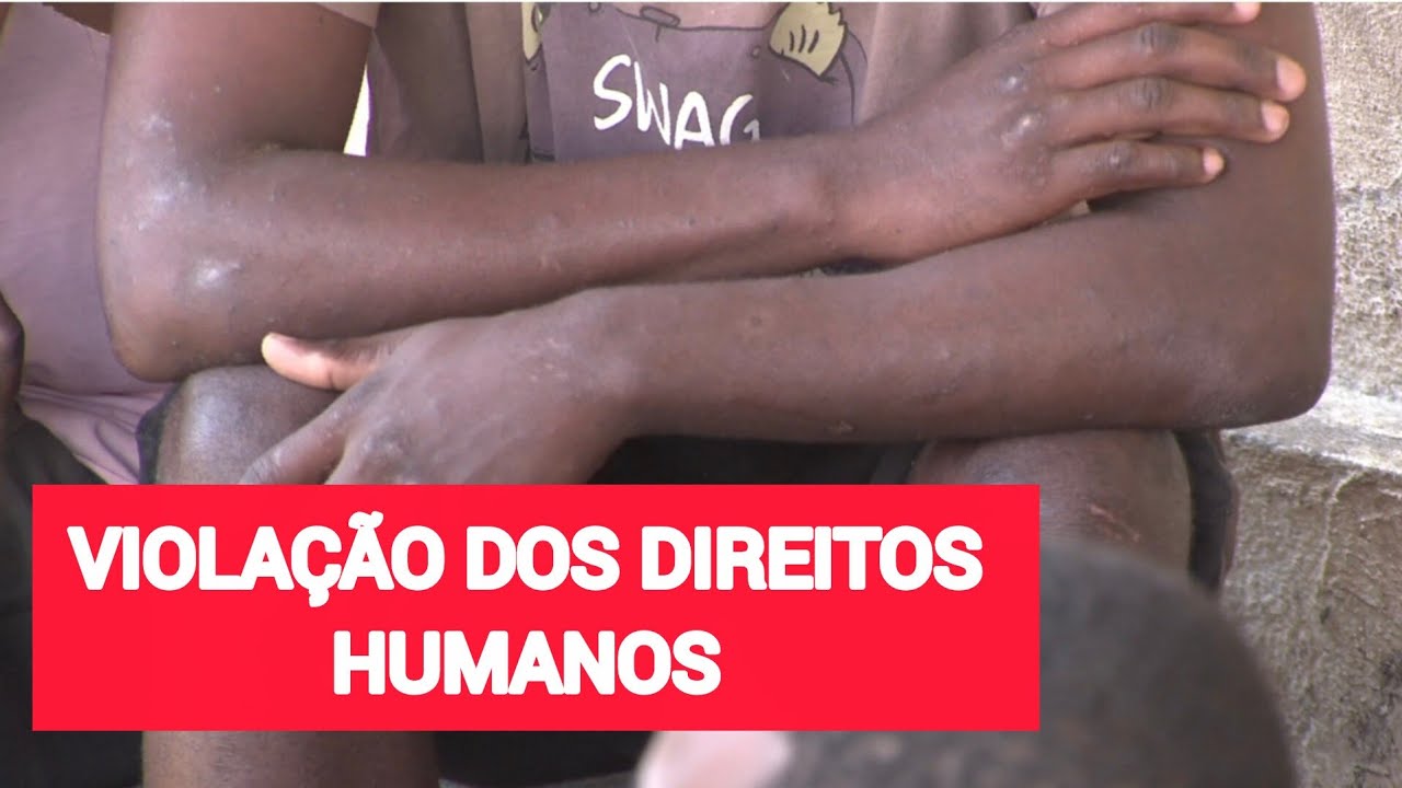 🔴CADEIA CÍVIL NACALA: