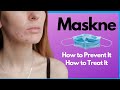 How to Prevent and Treat Maskne (Dermatology Experts)