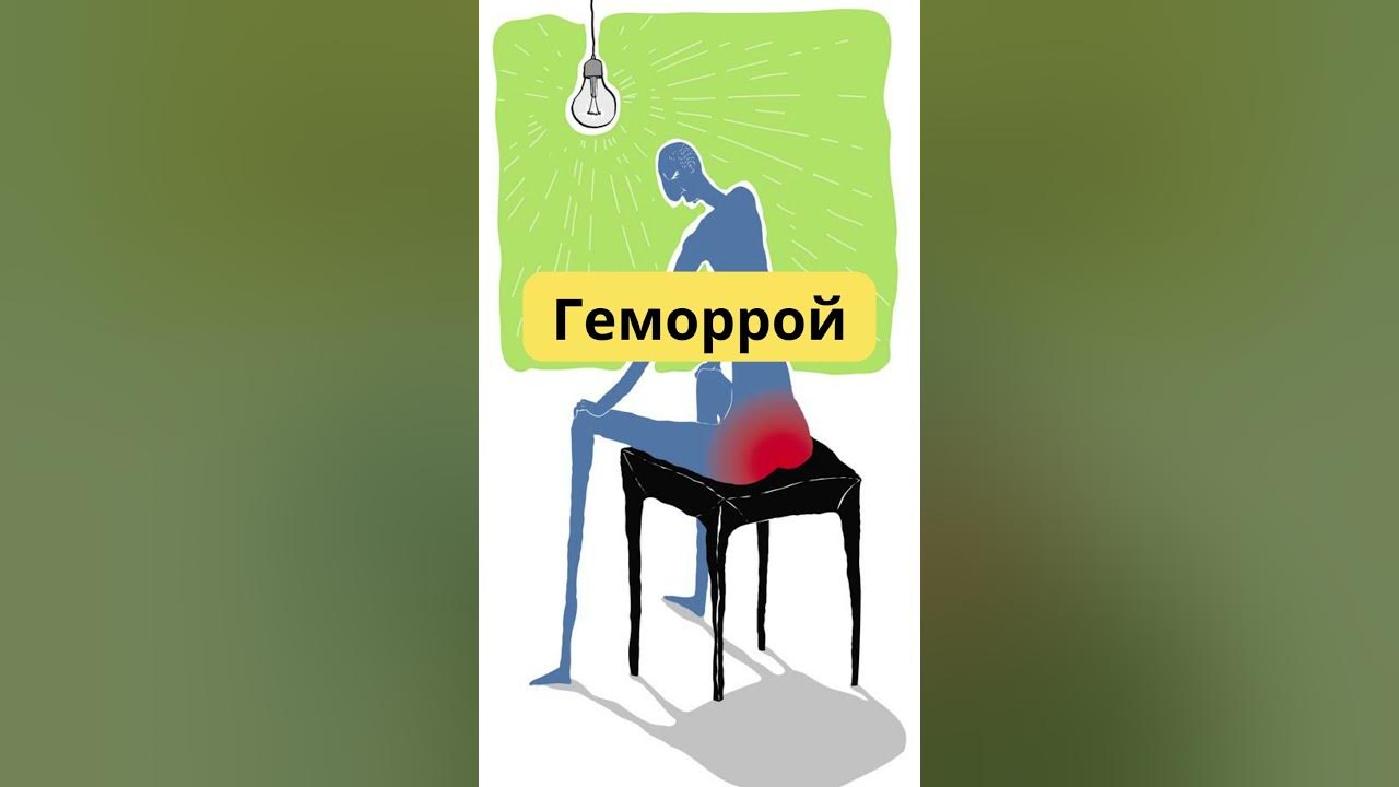 Лечение геморроя - YouTube