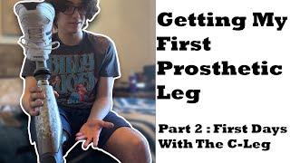 Getting My First Prosthetic Leg | Part 2 : First Days With The C-Leg