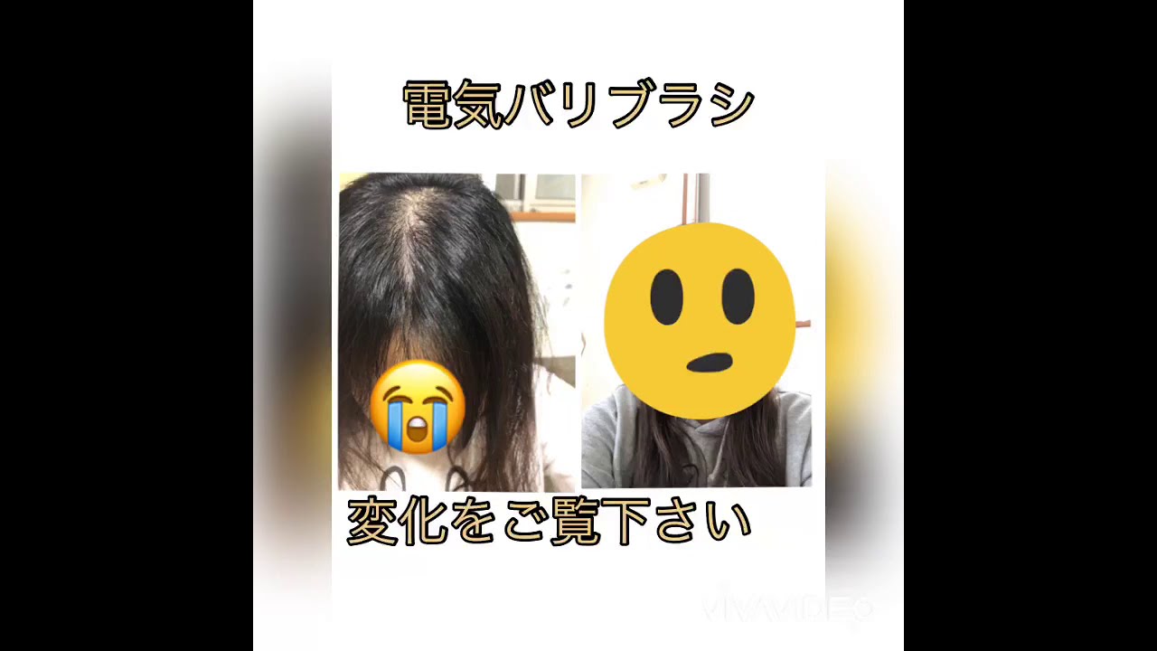 女性の薄毛 電気バリブラシを使ってみた 若ハゲ Youtube 女性の薄毛 電気バリブラシを使ってみた 若ハゲ Youtube