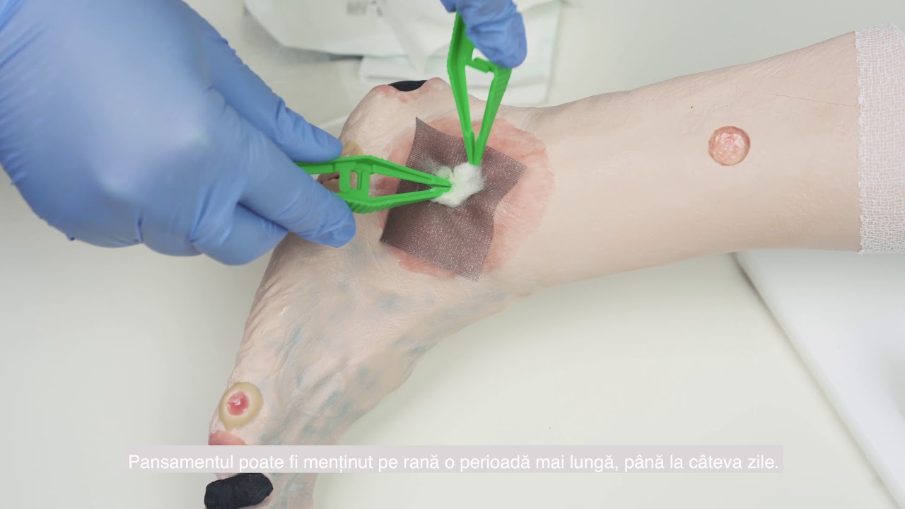 Medicament pentru umflarea venelor