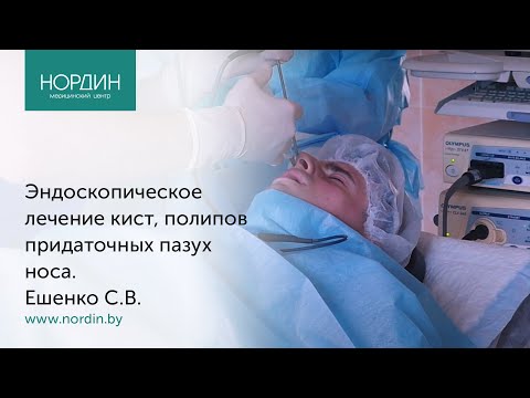 Эндоскопическое лечение ЛОР-патологии - удаление кист, полипов придаточных пазух носа