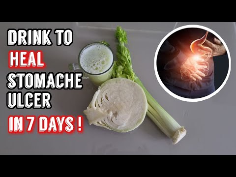 Video: Verhinderung von Cabbage Looper-Schädlingen - Erfahren Sie, wie Sie Cabbage Looper loswerden