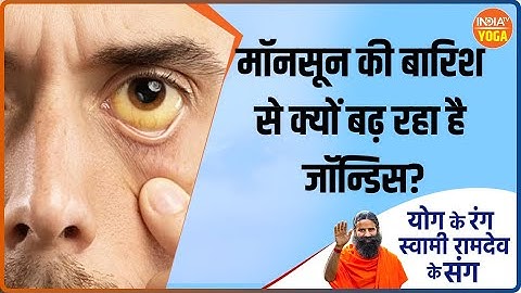 Yoga for Jaundice: Jaundice will go away instantly with this yogasana | Yoga for Life | Yoga Tips