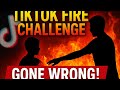 Viral TikTok Fire Challenge Nearly Killed a 12-Year-Old | True Story
