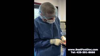 Dr. Nelson Removes a Neuroma