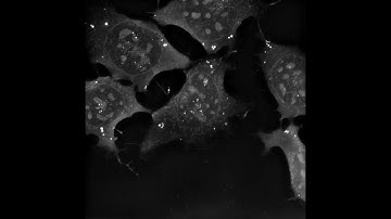 STEM CELLS: Long Term Live Imaging of Mouse Embryonic Stem Cells for 34 hours