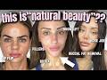 This Is Now What Natural Beauty Is Fillers Sausage Lips Botox Etc This Is Now What Natural Beauty Is Fillers Sausage Lips Botox Etc