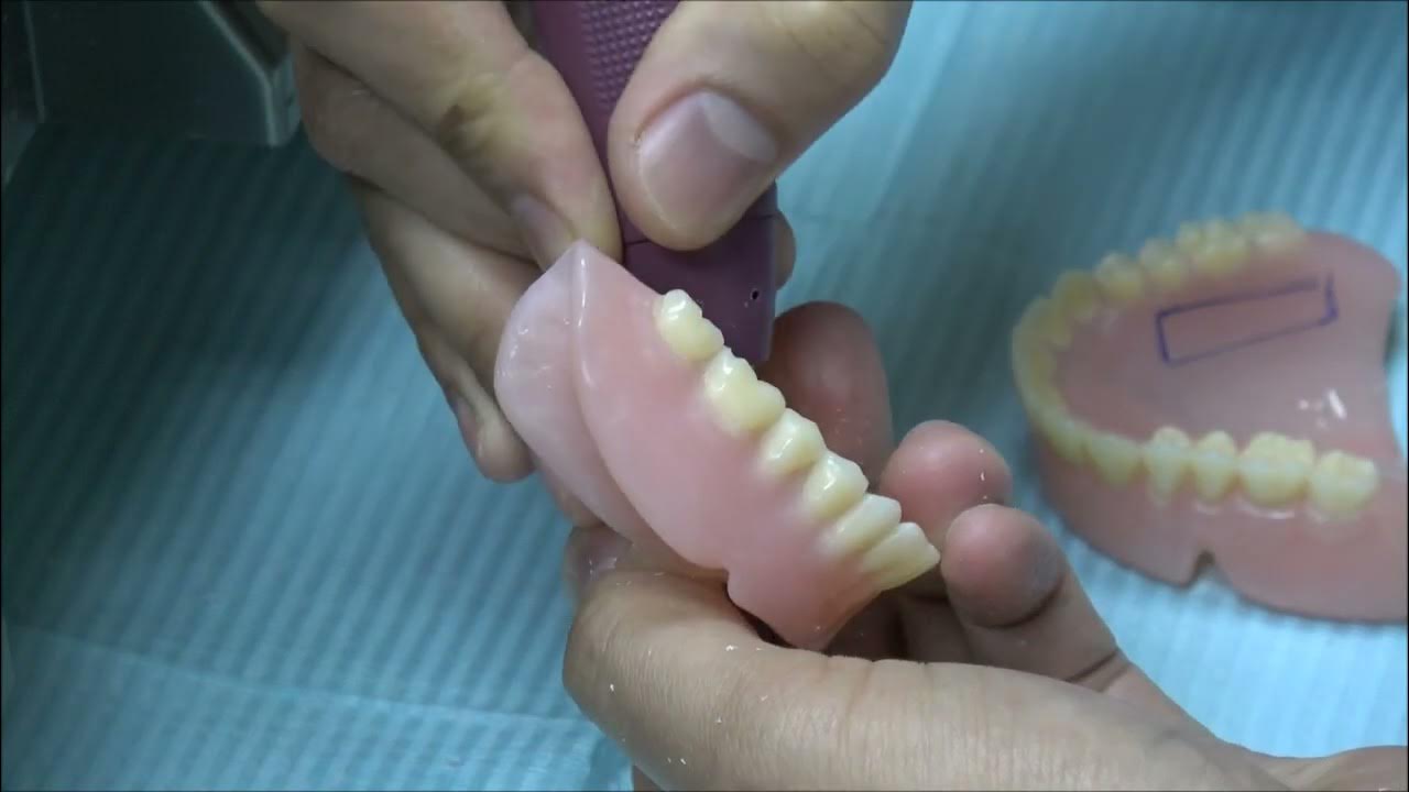 COMPLETE DENTURE 19 Denture Labeling YouTube