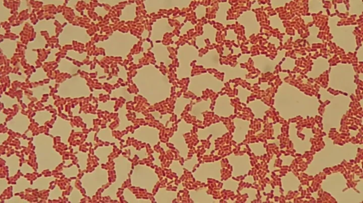 Stenotrophomonas maltophilia Gram staining