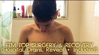A Raw Documentary: FTM Top Surgery & Recovery