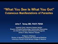 Cutaneous Manifestations of Parasites John Toney, MD
