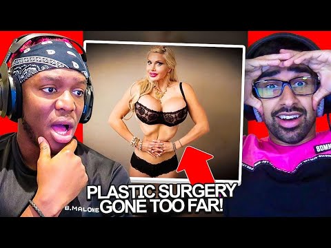 SIDEMEN REACT TO PLASTIC SURGERY GONE TOO FAR?