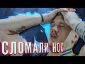 Liquid сломали Зевсу НОС