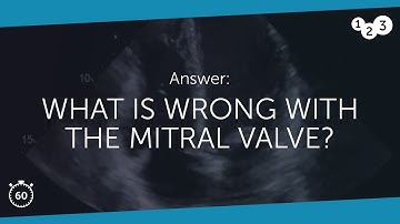 60 Seconds of Echo Teaching Answer: What is wrong with the mitral valve?
