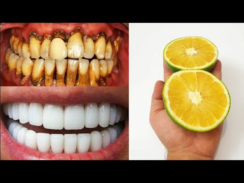 In just two minutes, white teeth whiten and shiny like pearls, this ...